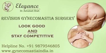 Revision Gynecomastia Surgery