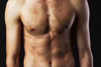Skin Excess